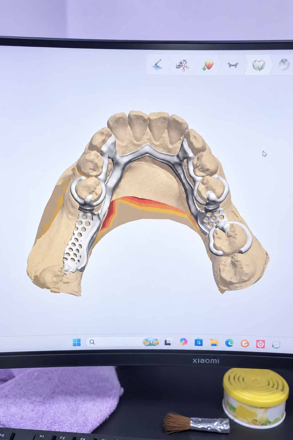 Modelo digital para planear una rehabilitación dental