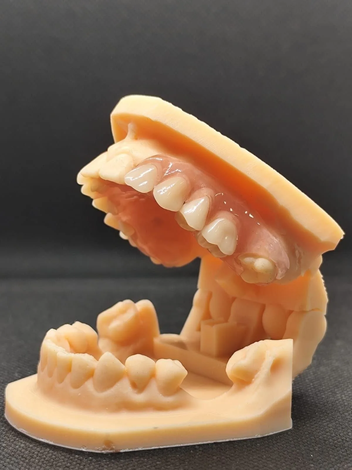 Modelo dental con restauración